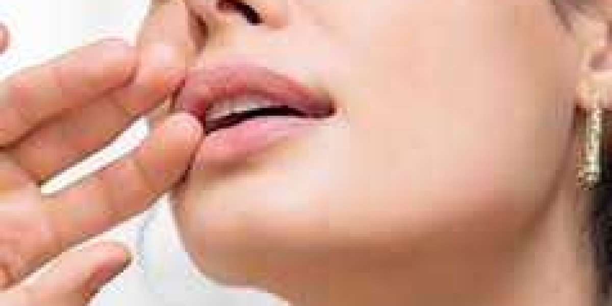 Muskelrelaxans vs. Filler: Die wichtigsten Unterschiede einfach erklärt