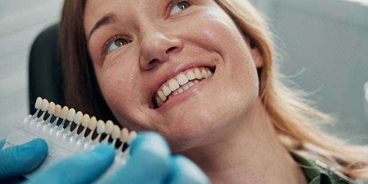 Unlock a Radiant Smile with Dental Veneers