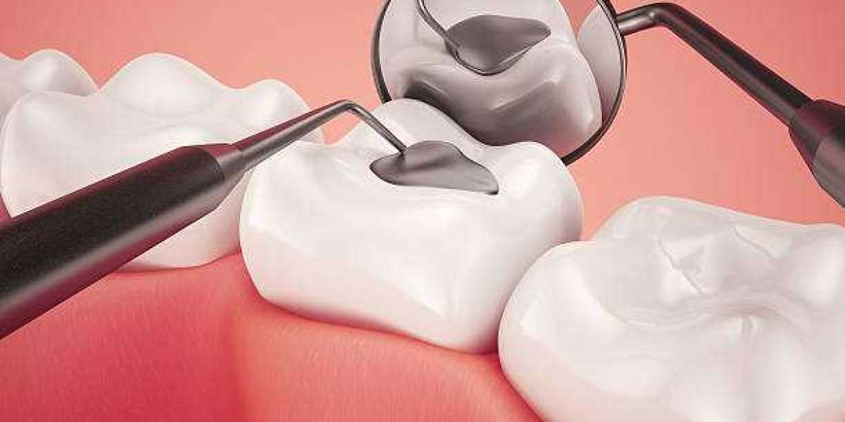 Painless Dental Fillings in Islamabad for Stronger Teeth