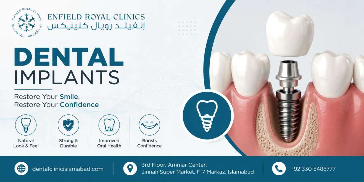 The Lasting Solution for Missing Teeth Dental Implants:
