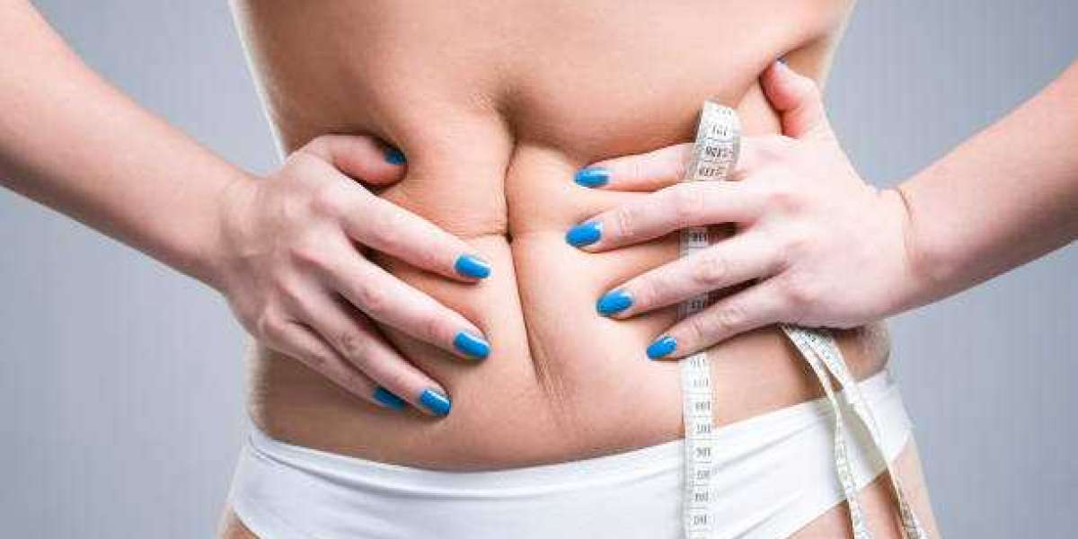 How Much Fat Can Be Removed During Liposuction?